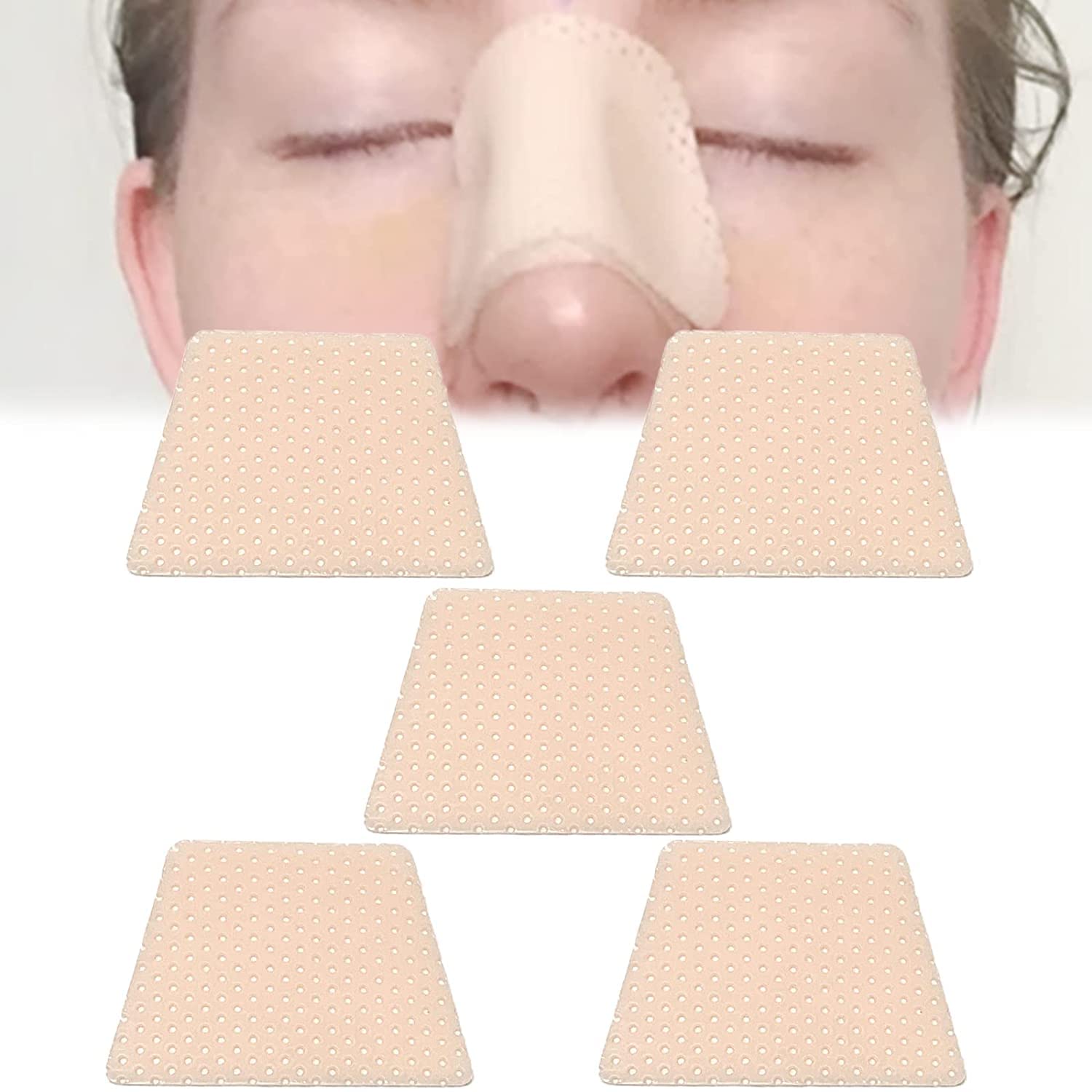 Thermoplastic Nasal Splints - Nose External Support Protector for Nose Brace Fracture, Rhinoplasty Septoplasty Surgery, ENT, Orthopedic Immobilization,5 PCS (Small (Pack of 5))