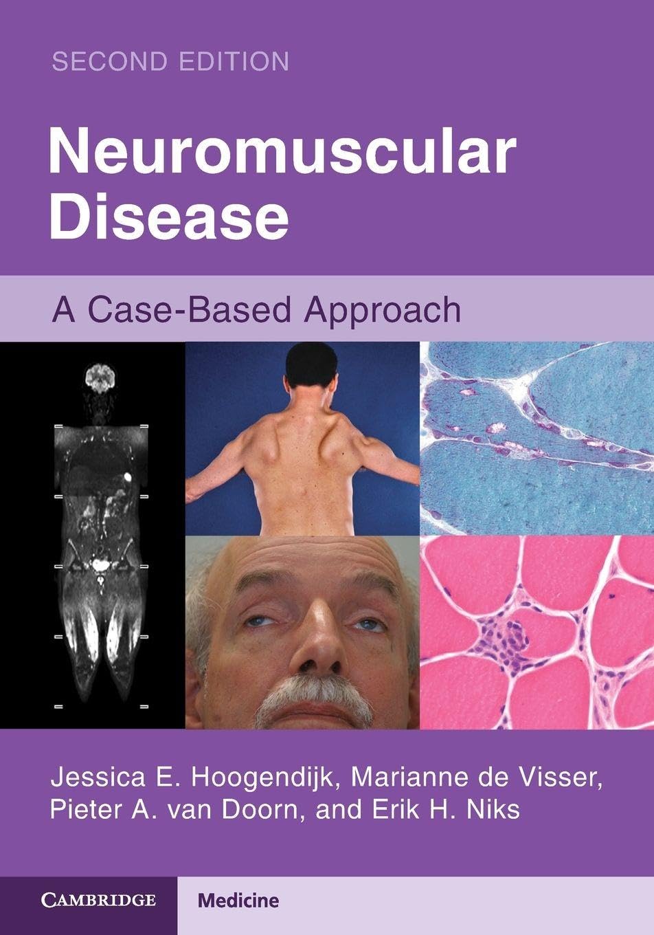 Neuromuscular Disease by Jessica E. Hoogendijk PAPERBACK 9781108744188