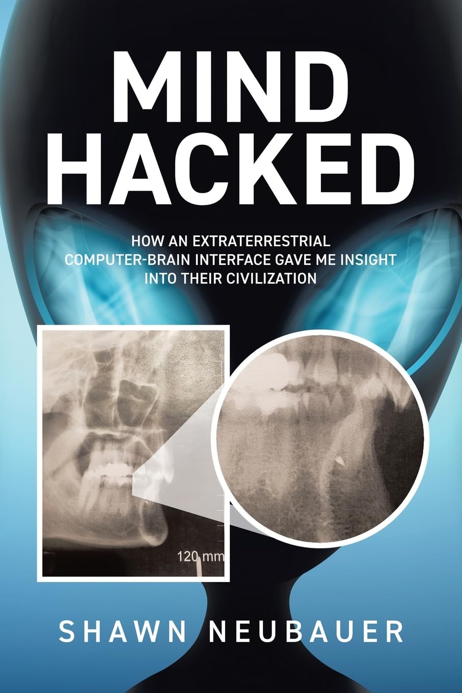 Mind Hacked: How an Extraterrestrial Computer-Brain Interface Gave Me Insight Into Their Civilization