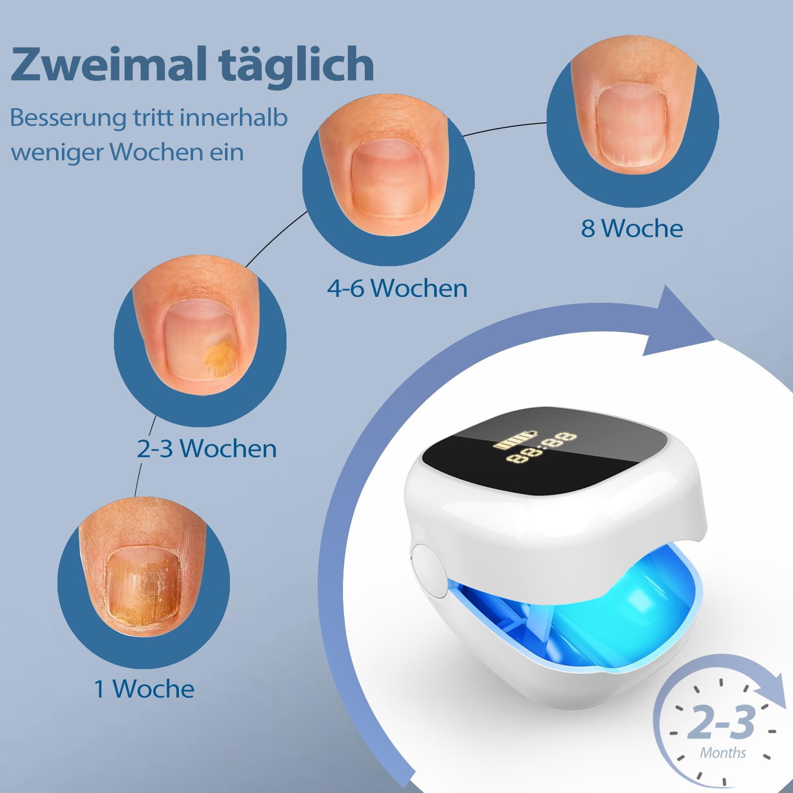 Podoclear Nagelpilz Lasergerät 470 nm blaues Licht 910 nm Infrarotlicht tragbares Behandlungsgerät digitaler Anzeige