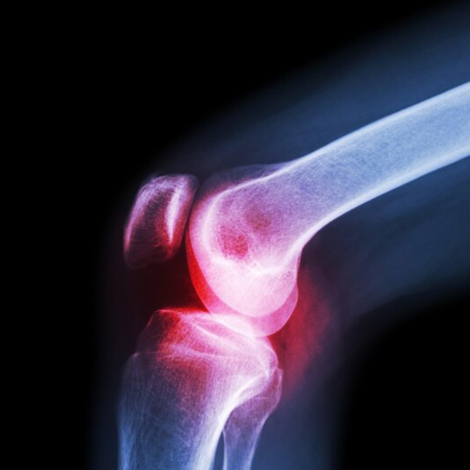Wowli Knee Cap Support for Joint Pain Relief and Injury Recovery with Hot & Cold Treatment 3