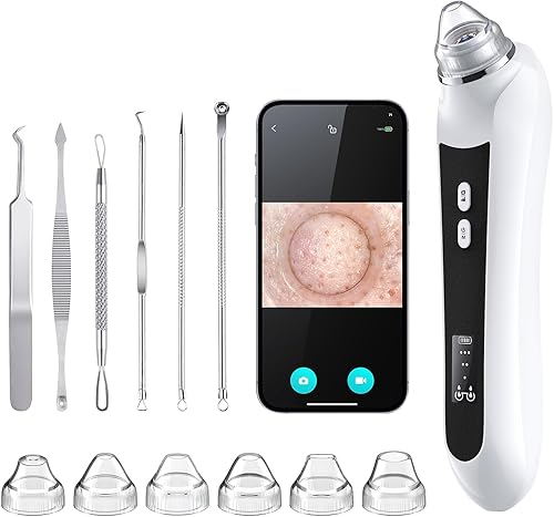 Aspiradora removedor de puntos negros, aspiradora de poros tipo interfaz USB, herramienta de extracción de cabeza negra con cámara para hombres y