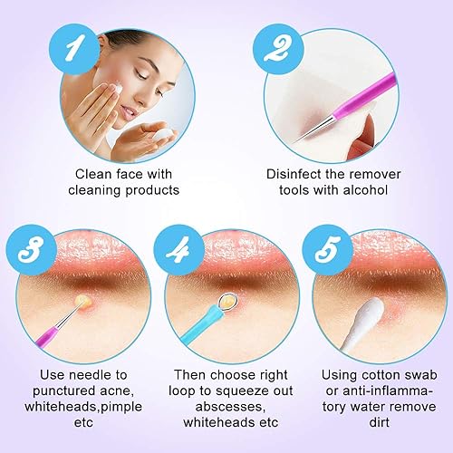 Miniatura 6 de Aooeou - Juego de herramientas para eliminar puntos negros 10 unidades herramientas profesionales para eliminar espinillas puntos negros manchas