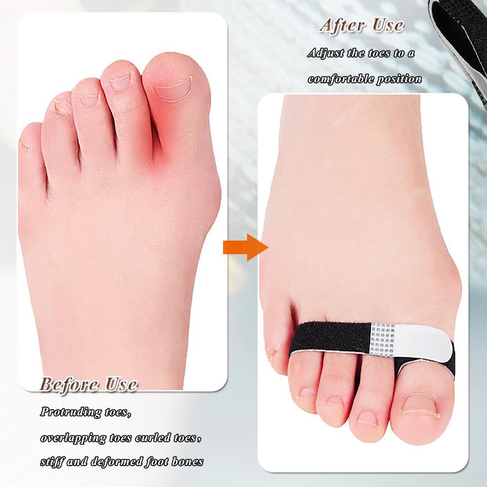 Buddy Tape Finger Straps, 6 Pcs Hook and Loop Finger Splint Reusable Finger Buddy Straps Index Finger Splint Buddy Tape Toe Straighteners for Curled Toes (6pcs black)