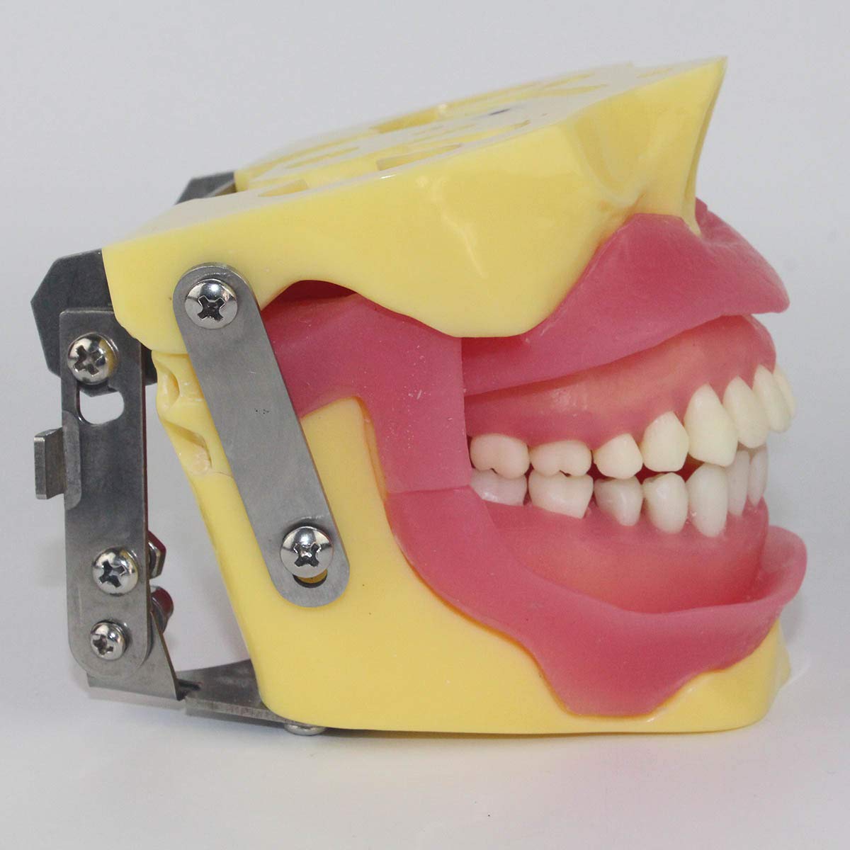 Modèle D'éducation - Modèle Dentaire Dentaire - Tiration De Chirurgie Buccale Anesthésie Opération Extraction Modèle De Démonstration - pour Aider À La Formation Médicale