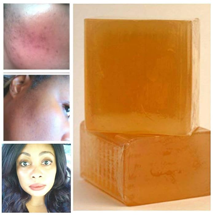 Buy Non Comedogenic Soap Bar, kojic acid 4 Divine Goddess Bleaching