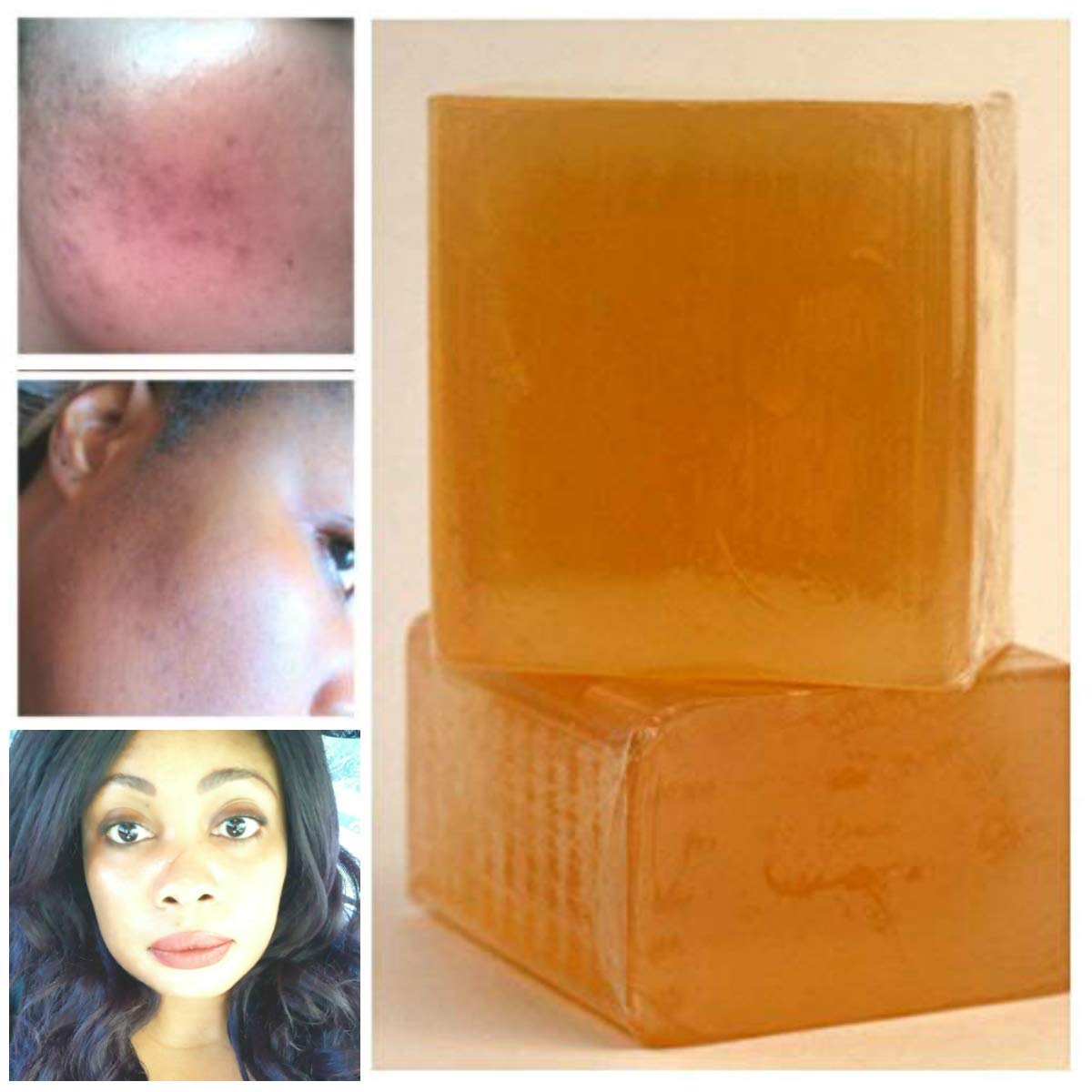 Buy Non Comedogenic Soap Bar, kojic acid 4 Divine Goddess Bleaching