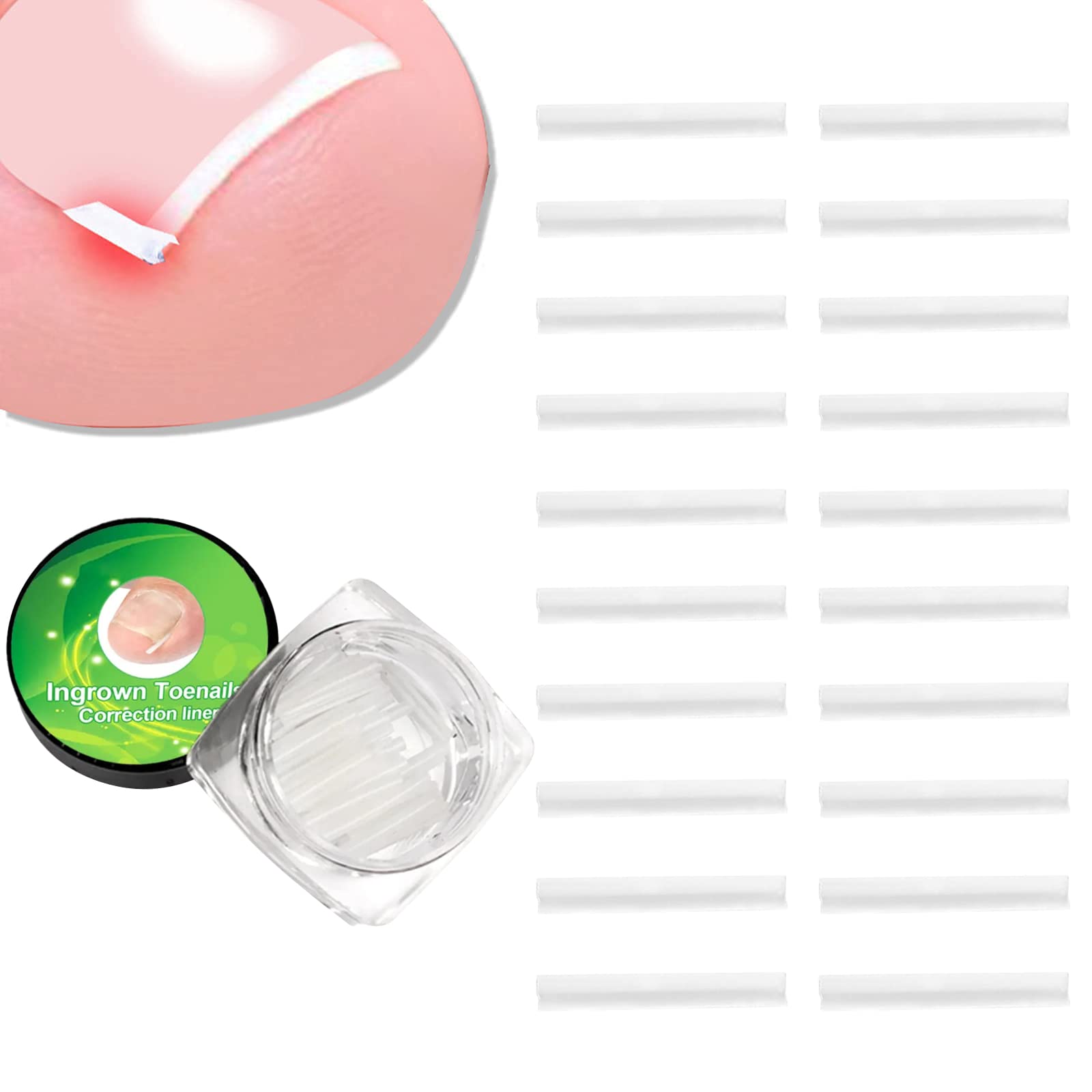 Buy Ingrown Toenail Correction Strips Brace Kit,20 Pcs Ingrown Toenail