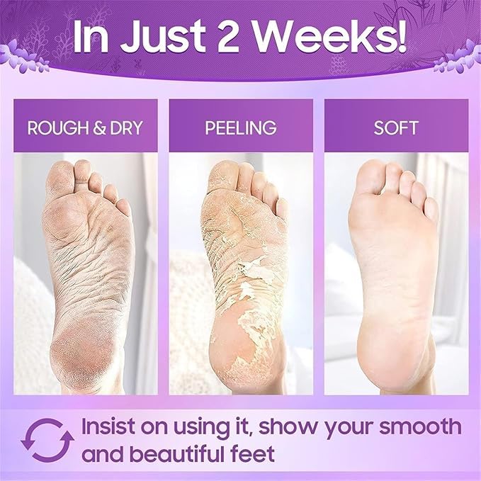 ERITIN Foot Peel Mask for Women & Men | Peeling & Exfoliating Foot Mask for Dry Cracked Feet, Removes Dead Skin & Calluses, Hydrates & Smooths Cracked Heels (Pack of 1) (LAVENDER) 4