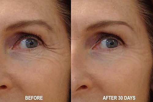 Miniatura 3 de DNA Code®-Sin Aguja Alternativa-Péptidos Argireline Puros Reducen Suero+Matrixyl 3000+Ácido Hialurónico