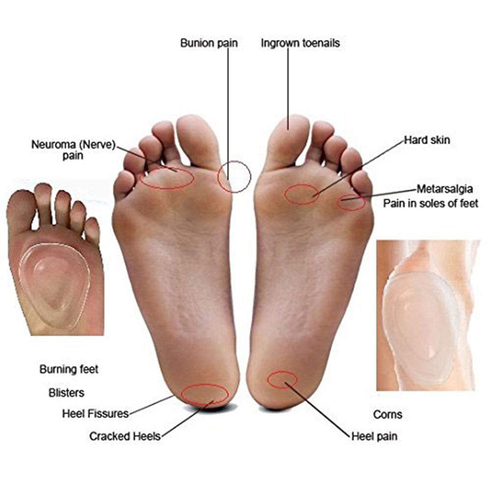 Pedimend, solette in silicone per metatarsalgia (5 paia, 10 pezzi), cuscinetto in morbido gel per sollievo dal dolore, sollievo dal dolore causato da metatarsalgia, neuromi, atrofia e sensazioni di