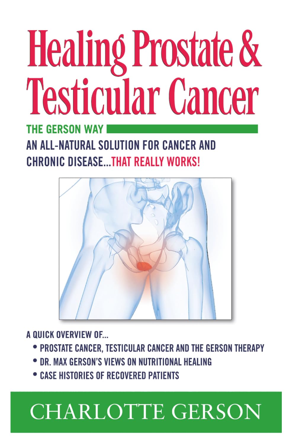 Healing Prostate & Testicular Cancer: The Gerson Way