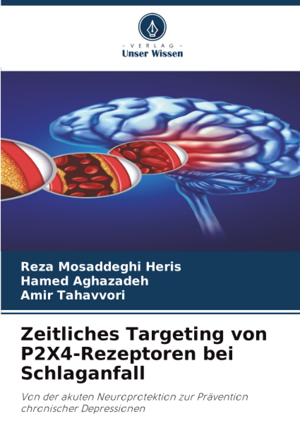 Zeitliches Targeting von P2X4-Rezeptoren bei Schlaganfall: Von der akuten Neuroprotektion zur Prävention chronischer Depressionen