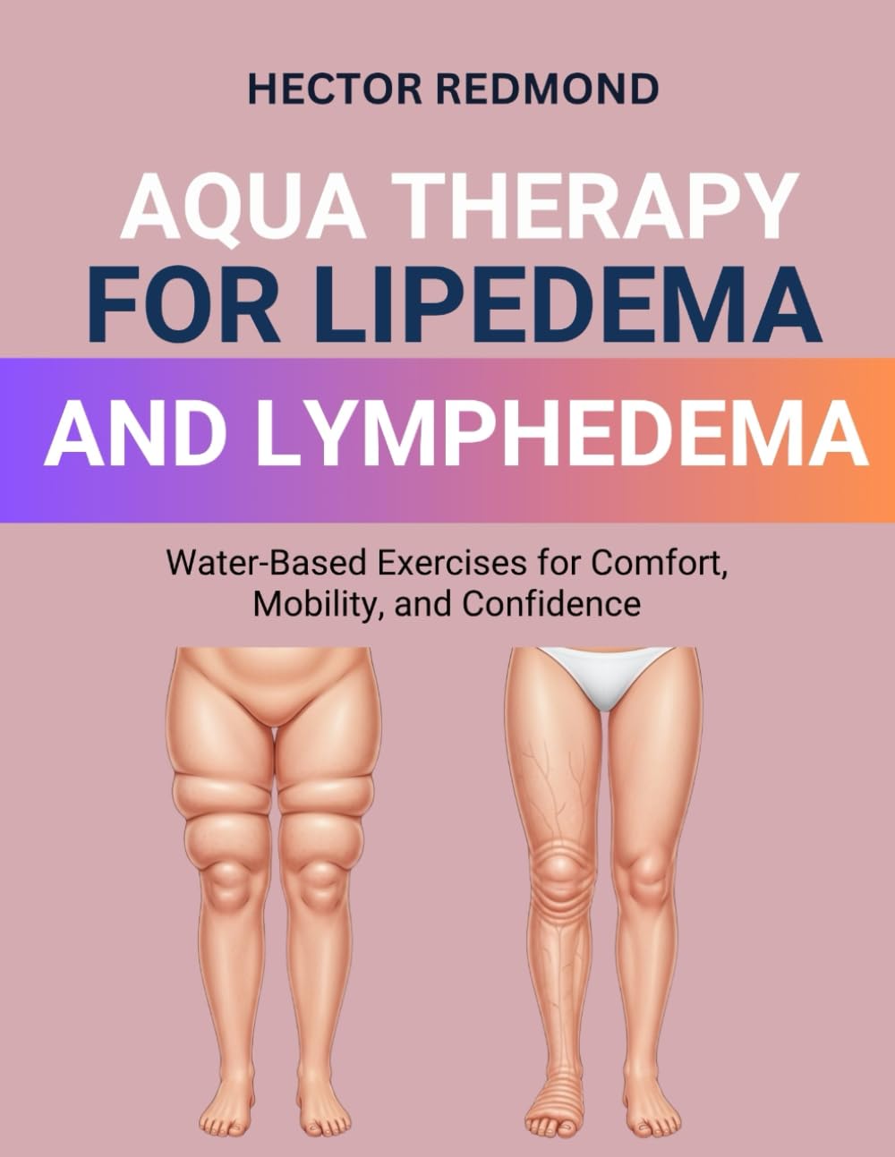 Aqua Therapy for Lipedema and Lymphedema: Water-Based Exercises for Comfort, Mobility, and Confidence