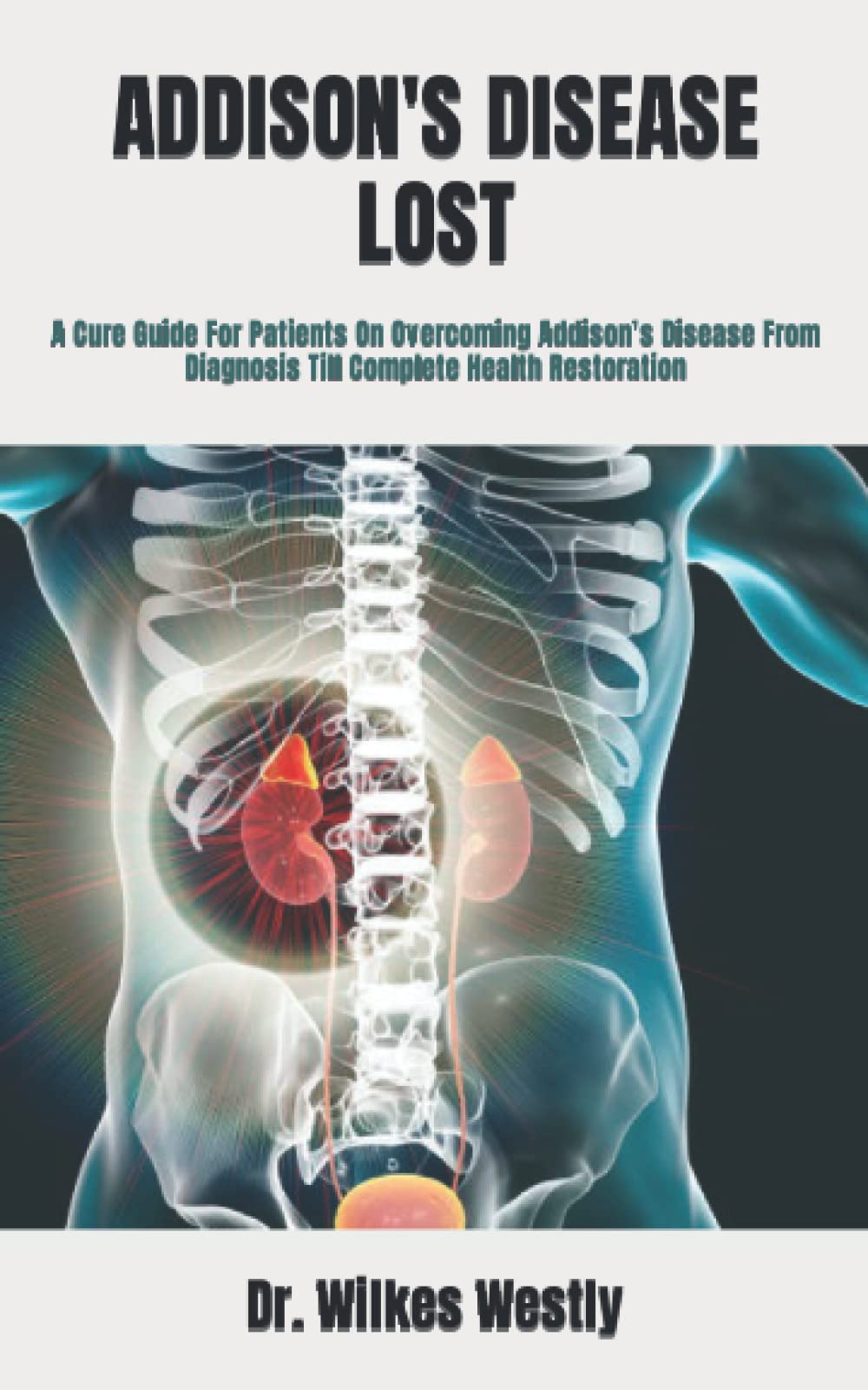 Buy ADDISON'S DISEASE LOST A Cure Guide For Patients On