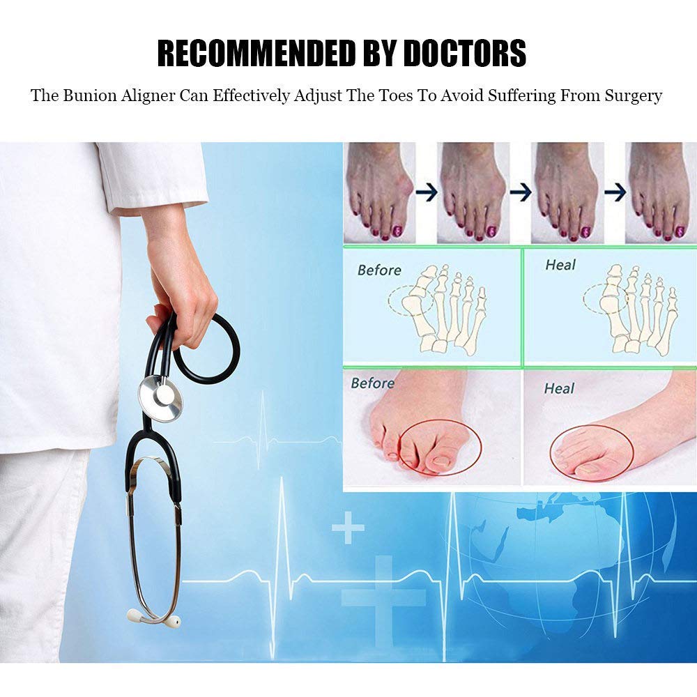 TILEZE Korrektor, Zehenglätter, bequemer Zehenspreizer aus Silikon, für Plantarfasziitis, Hallux Valgus, überlappende Zehen, 2 Stück, Tag und Nacht erhältlich