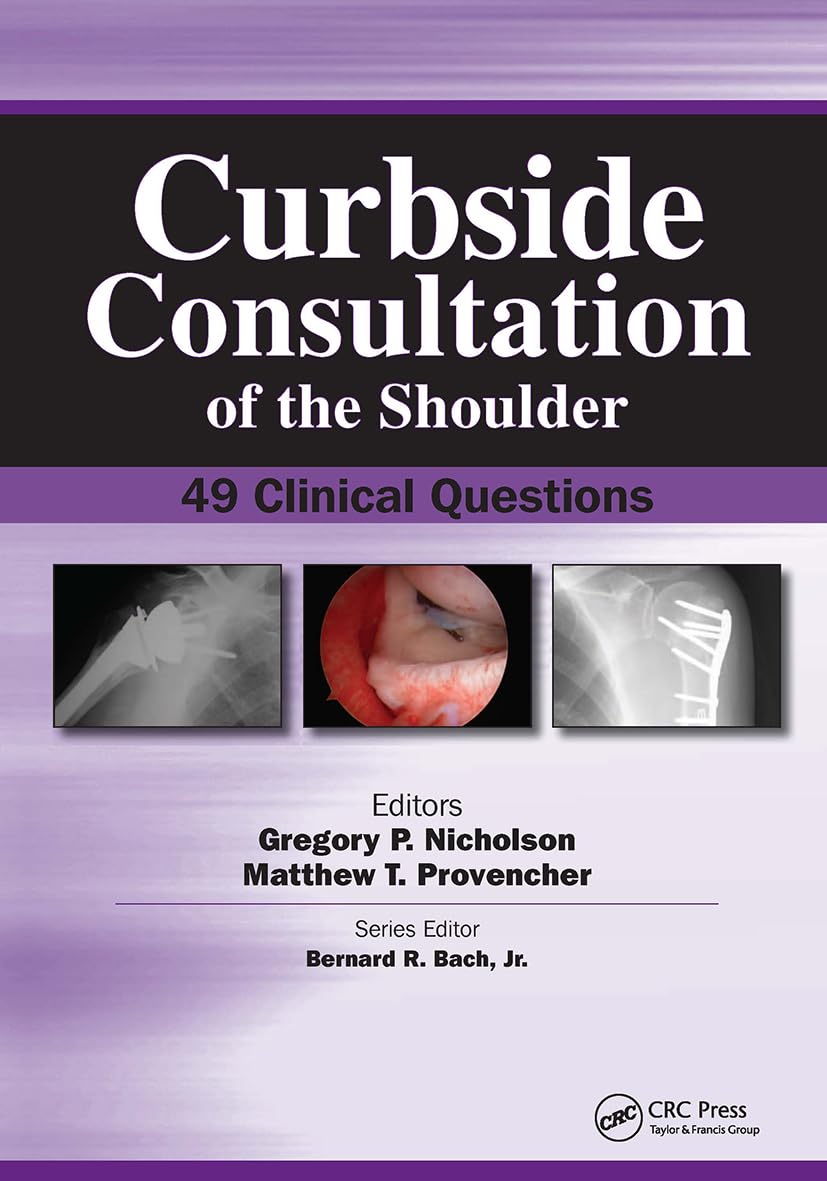 Buy Curbside Consultation of the Shoulder: 49 Clinical Questions (Curbside Consultation in Orthopedics) — BookShops.in
