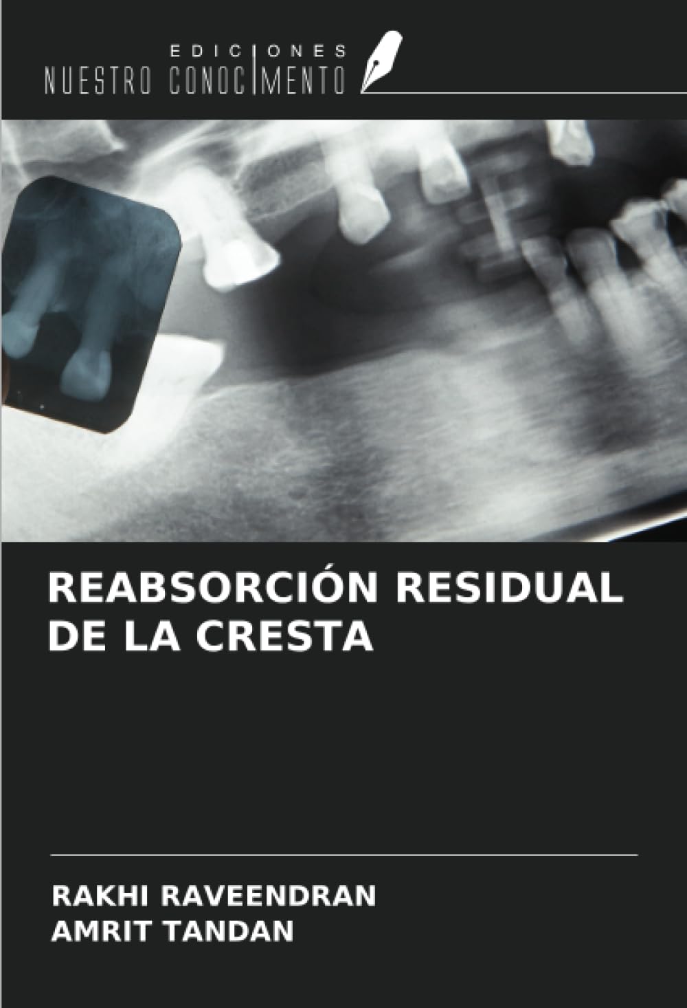 REABSORCIÓN RESIDUAL DE LA CRESTA
