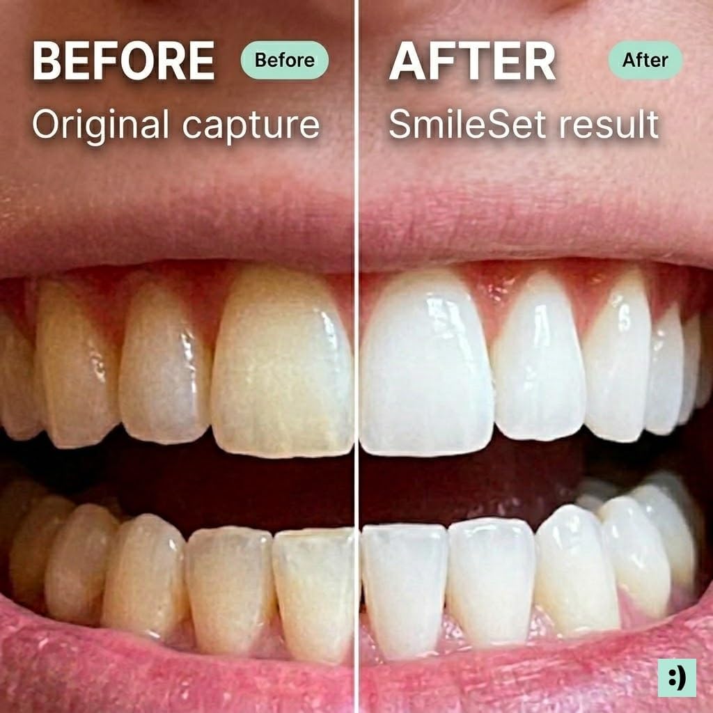 Premium LED Teeth Whitening Kit – 32 Light Professional At-Home System with 35% Carbamide Peroxide Gel, 4 Whitening Pens, Cordless Device, Sanitizing Charging Base, 6 Month Supply - Black