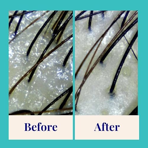 Miniatura 3 de The Powder Shampoo - Champú en Polvo Botella de Aluminio Purificador y Regulador Champú (Tomillo y Menta) - 2.47 oz