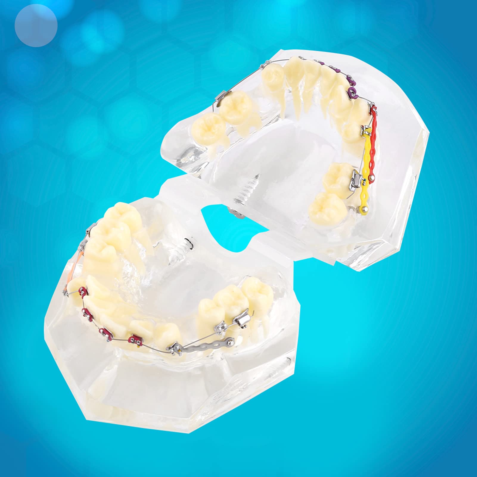 Staffe Ortodontiche, Modello di Denti Trattamento Ortodontico Dentale Studio di Malocclusione Modello di Denti con Staffe Dentali a Catena Metallica