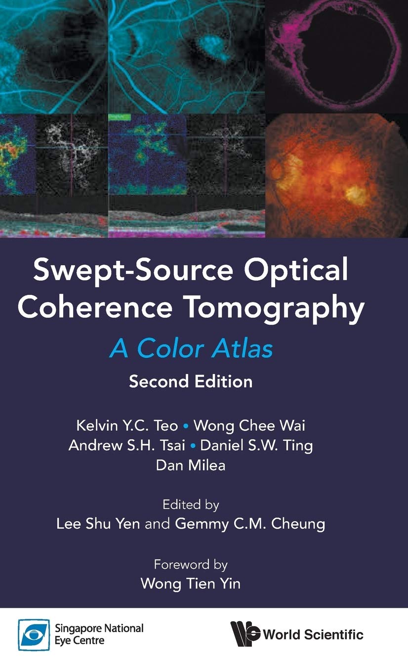 Swept-Source Optical Coherence Tomography: A Color Atlas