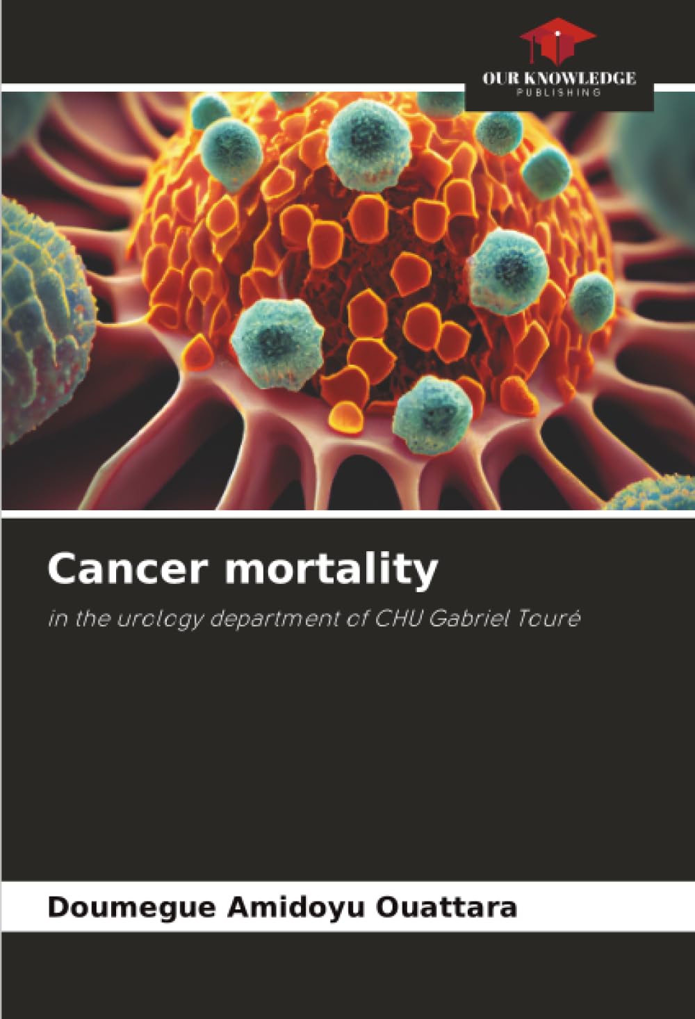 Cancer mortality: in the urology department of CHU Gabriel Touré
