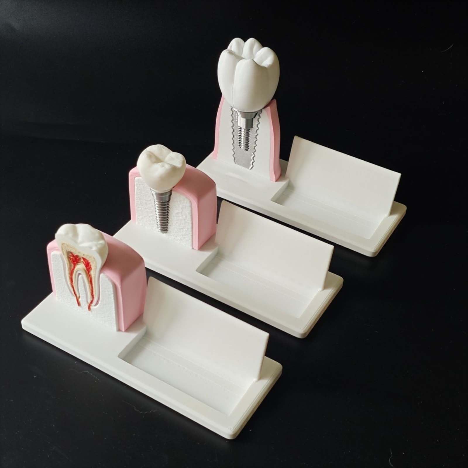 Portatarjetas de Visita de Clínica Dental Modelo de Implante Dental y Conducto Radicular para Hombres y Mujeres Soporte de Escritorio para Nombre Tarjeta Organizador de Tarjetas