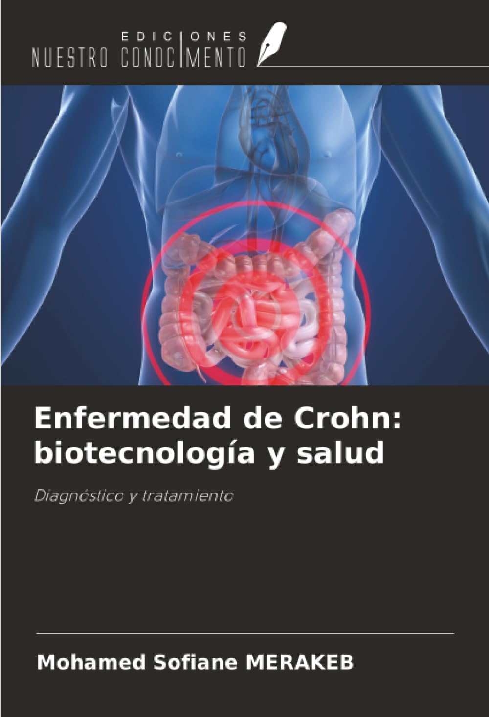 Enfermedad de Crohn: biotecnología y salud: Diagnóstico y tratamiento