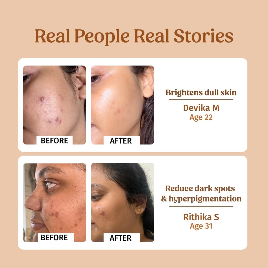 Vilvah Store Milk Drops Brightening Serum Formulated With Rice Milk Extract, Marine Algae Extract, Alpha Arbutin, Fades Scars, Brightens Skin & Even Skin Tone For All Skin Type, 40ml - Image 4 thumbnail