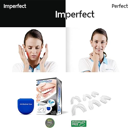 Miniatura 6 de The ConfiDental Protector bucal para rechinar dientes por la noche, modelo para dientes rechinados regulares, paquete de 6 protectores nocturnos
