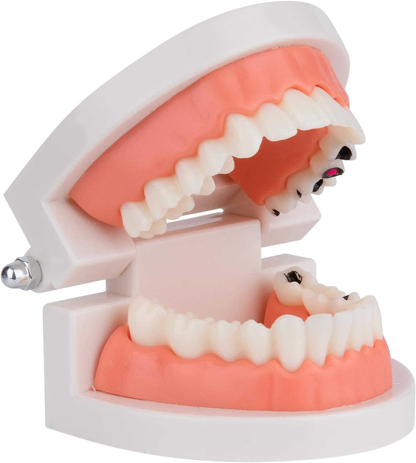 ANNWAHTooth Decay Model - Dental Decay Model Caries Teaching Tool - Standard 1:1 Fake Teeth Model Life Size Dental Hygiene Study Learning Tool for Kids Oral Care Education