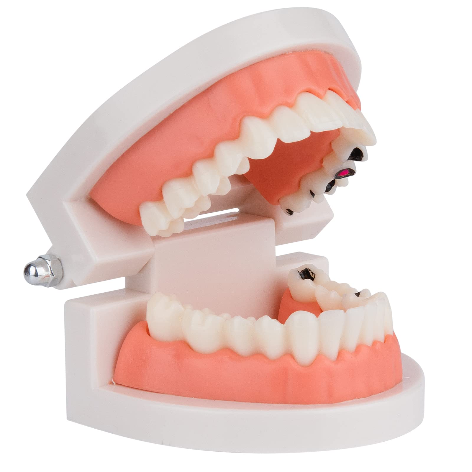 ANNWAHTooth Decay Model - Dental Decay Model Caries Teaching Tool - Standard 1:1 Fake Teeth Model Life Size Dental Hygiene Study Learning Tool for Kids Oral Care Education