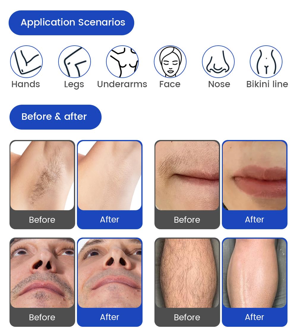 16 barre Epilazione laser 2 in 1 Rimozione tatuaggi con laser Pico | 755nm/808nm/940nm/1064nm Rimozione di macchie cutanee, rimozione di cicatrici da acne, rimozione di nei