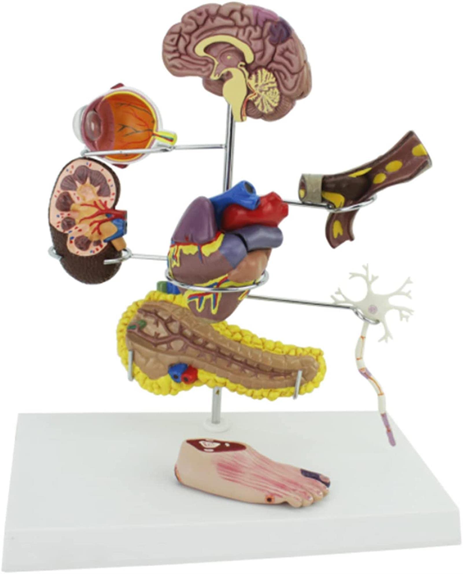 Diabetes Model Set Diabetes ical Model Human Organ Model Coronary Thrombosis Arteriosclerosis Model Extracorporeal Circulation Vascular Intervention for Display Teaching Model