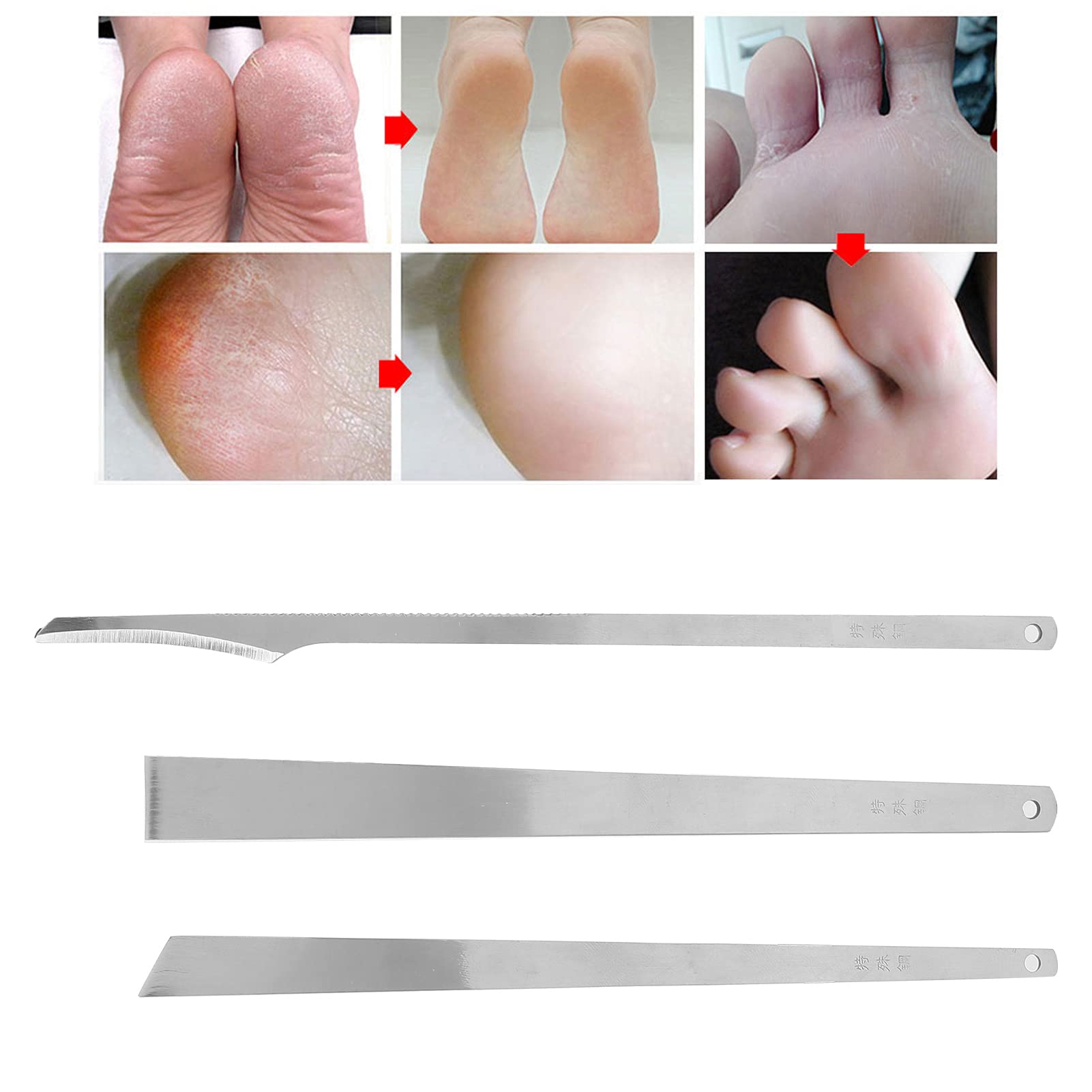 Professional 3pcs Steel Pedicure Knife Set, Stainless Steel Pedicure Blades and Callus and Cuticle Removal Kit, Home and Salon Pedicure Kit