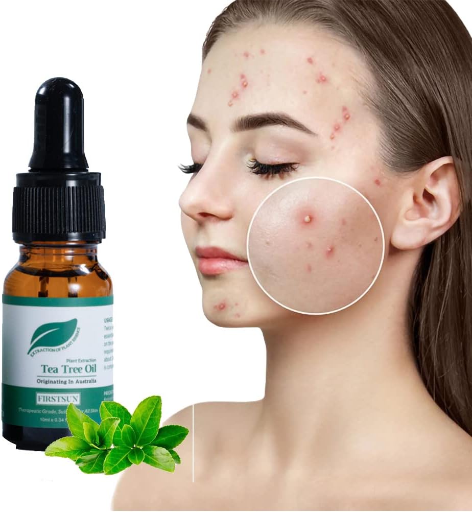 Madi Kay Designs Acne Treatment Tea Tree Essential Oil Anti Acne Fade Ace Mark Face Essence Shrink Pores Brightens Skin Tone Skin Care Products