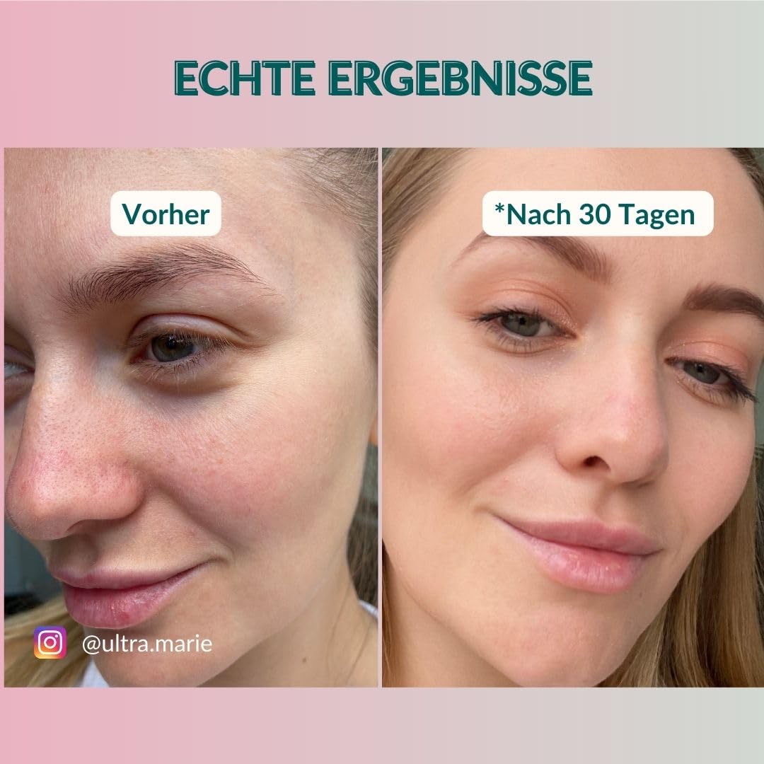 Waschgel zur Gesichtsreinigung mit Salicylsure & Bio Aloe Vera 150ml -  Naturkosmetik Face Cleanser zur Gesichtspflege mit Hyaluron - Anti Pickel  Reinigungsgel gegen Unreine Haut (150 ml) : Amazon.de: Kosmetik