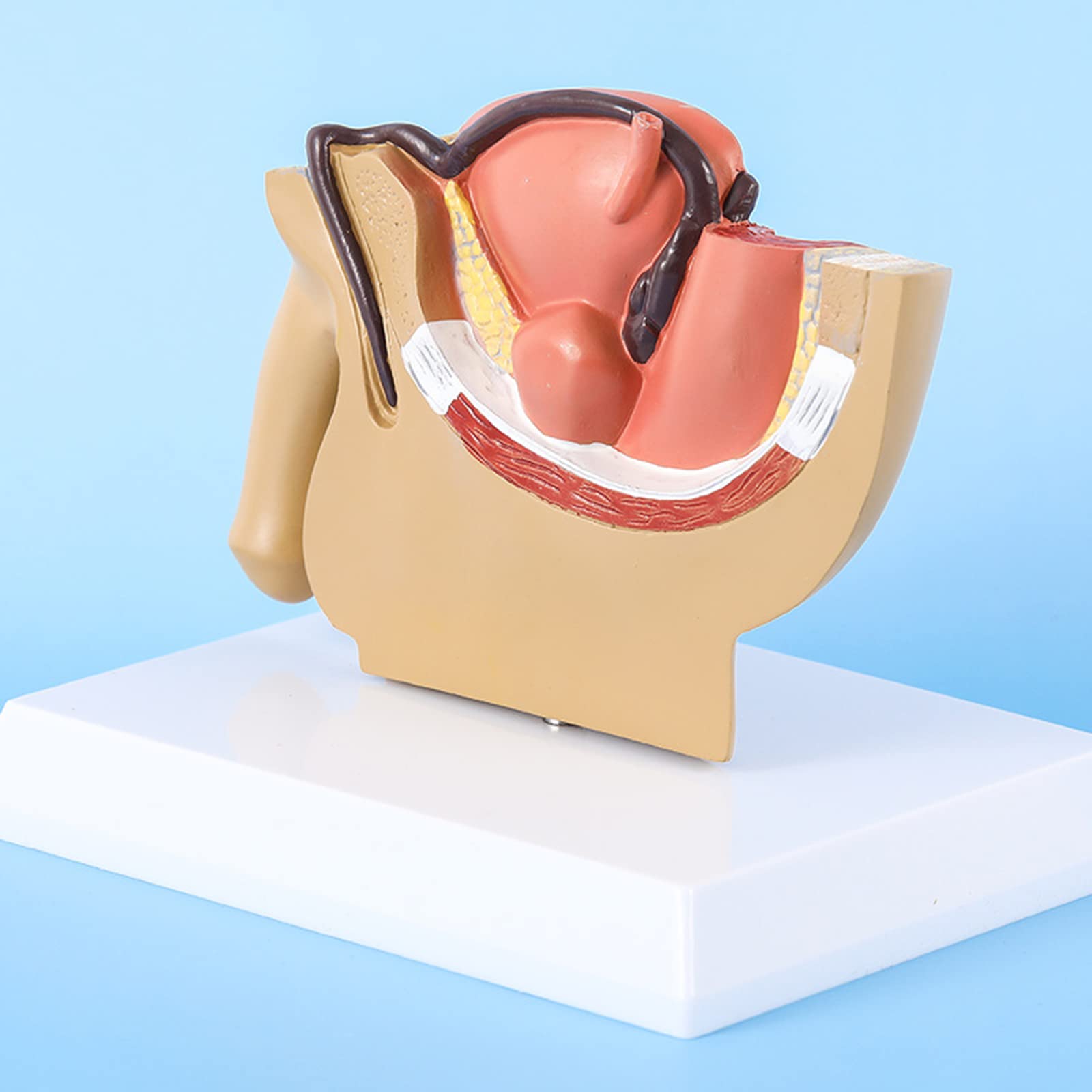 CcacHe Modelo de anatomía pélvica Masculina, Modelo anatómico patológico, Modelo de órgano médico para Estudio de investigación de Estudiantes de Medicina