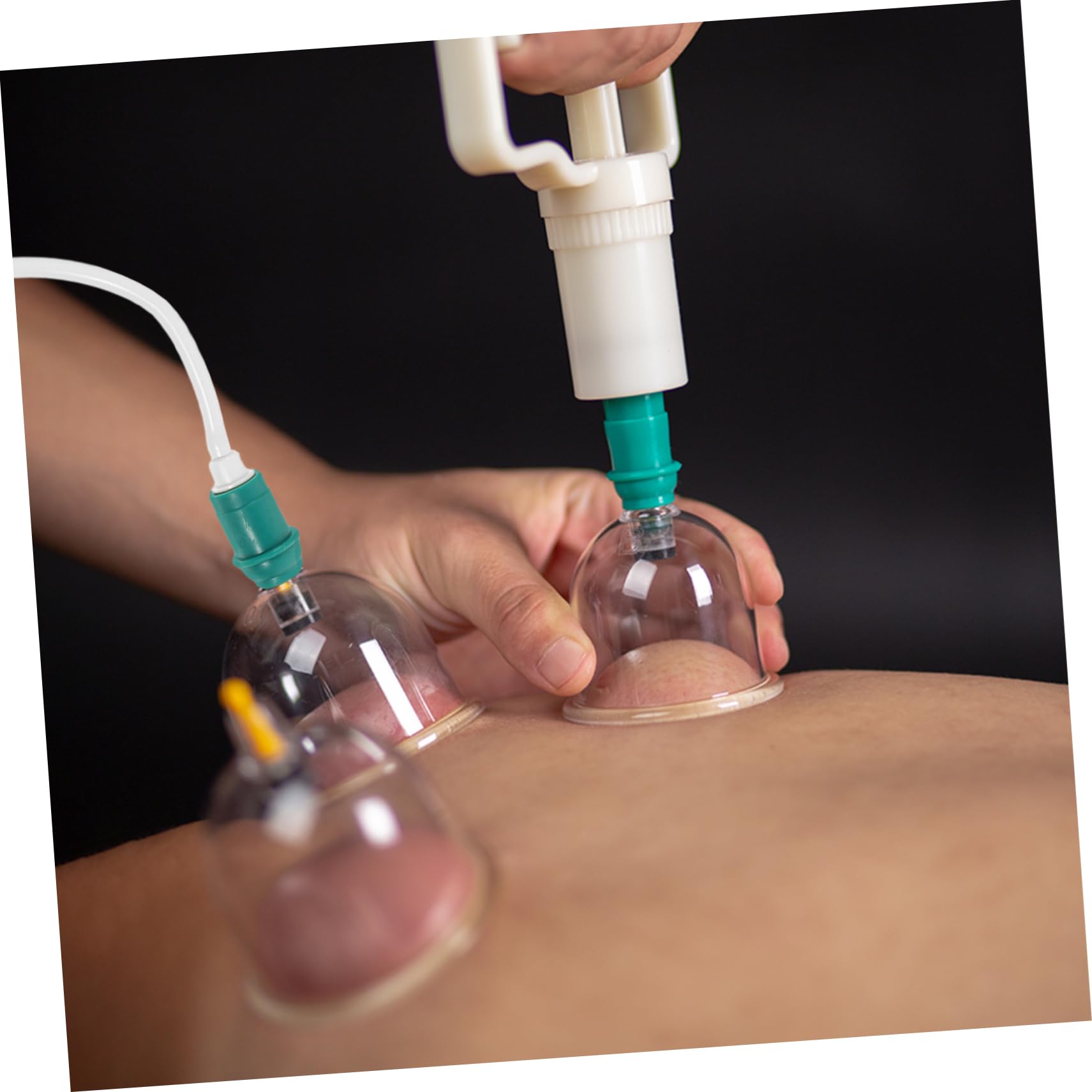 KOMBIUDA Enhance Your Cupping Practice Extended Length Portable Cupping Hose Easy Cupping Machines