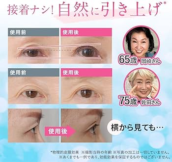 北の快適工房　リッドキララ　10g×4 まぶた用アイケアジェル 北の快適工房 リッドキララ 10g 北の達人コーポレーション