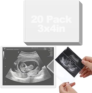 Easy Insert Photo Protector for 3x4in Ultrasound Pictures - Side-Loading to Keep Baby Sonogram Picture/Special Memories Safe, Pregnancy Journal Must Haves, Pregnancy Gifts for Expecting Mom, 20 Pack