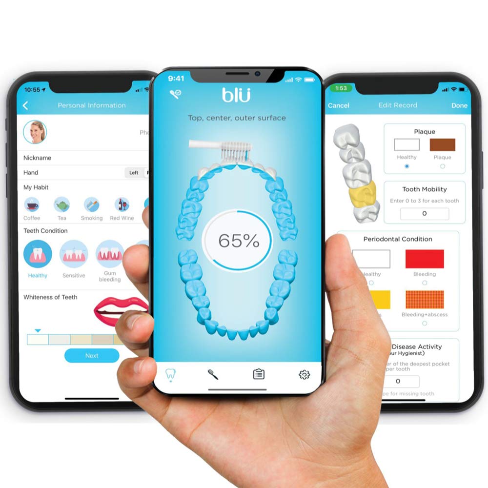 Blu Smart Spazzolino da denti con App, Unico Cordless Spazzolino da denti Elettrico Adulti, Uomini o Donne 40.000 Stroke al minuto, Timer, Impermeabile e Smart Tracking per IOS, Android (Nero)
