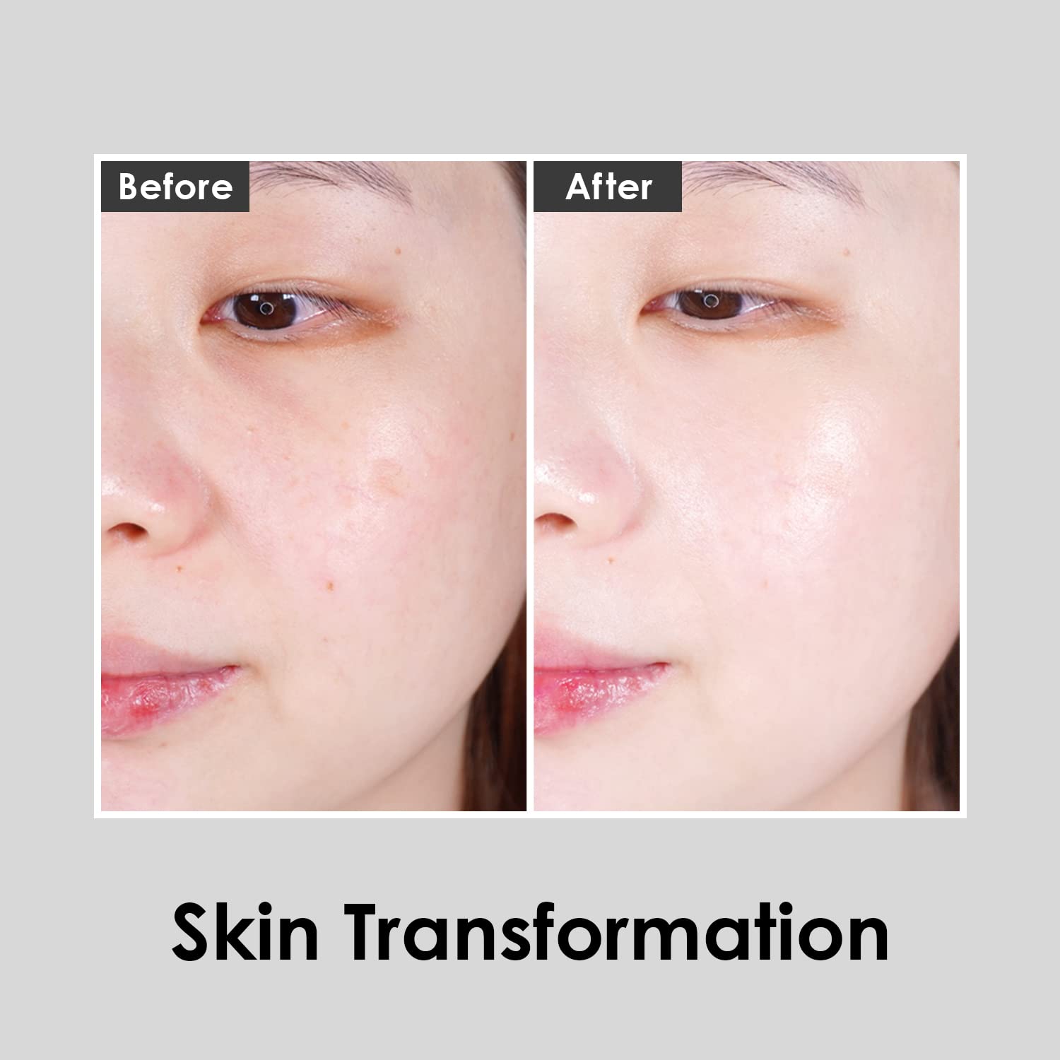 sinha et al. 2018 liposomal glutathione pmc6389332 Amazon.com: [MEDI-PEEL] Red Lacto Collagen Sun Cream 1.69 fl.oz / 50ml |  Patented Sebum Control, Firming Pore Function, Moisturizes and Smoothes  Skin Texture