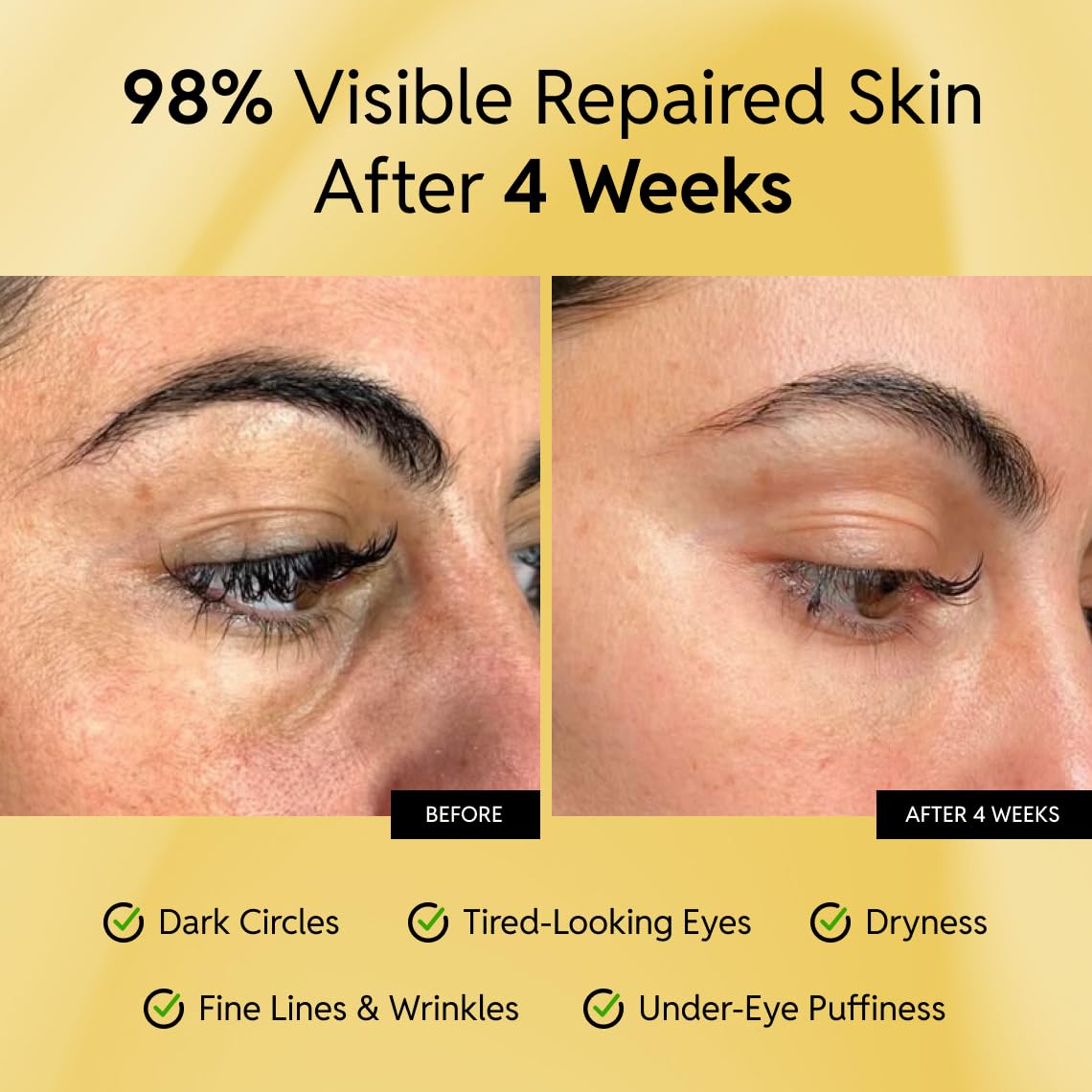 Eliré Crema occhi riparatrice - Ripristina e rafforza la pelle delicata sotto gli occhi | Con ceramidi e caffeina – riduce le linee sottili, rughe e gonfiore – ad assorbimento rapido – 15 ml