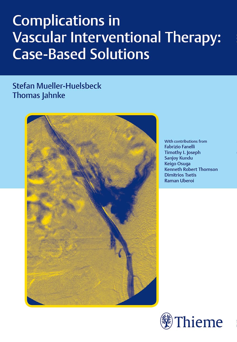 Complications in Vascular Interventional Therapy:Case-Based Solutions