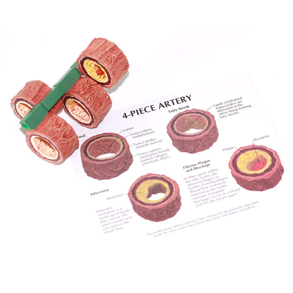Zoeyilan Arterie Anatomie Modell - 7-teiliges Gefäßmodell Für Medizinische Ausbildung
