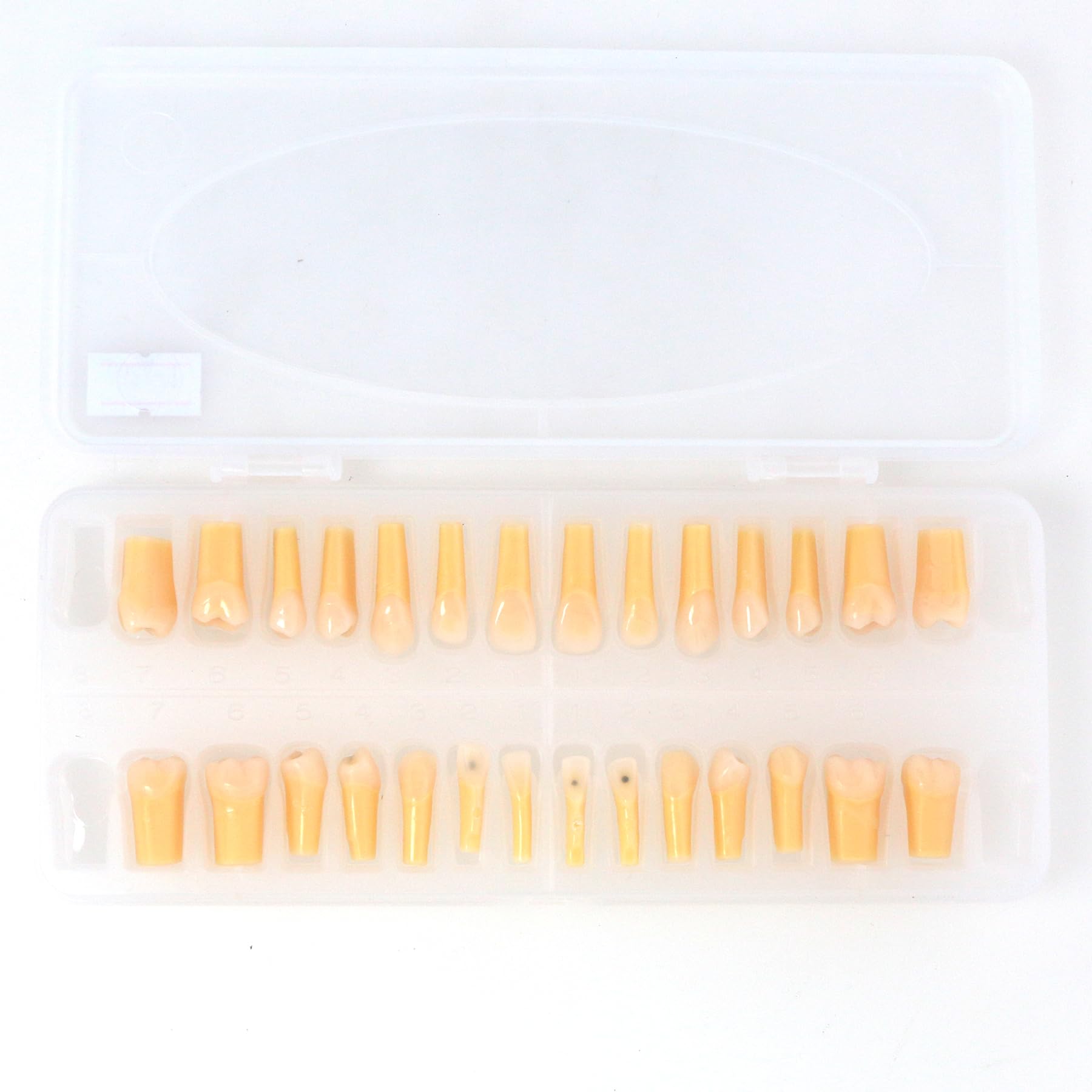 28 Pcs Dental Typodont Teeth Model with Caries Spots Fit for Kilgore Nissin 200 with Box