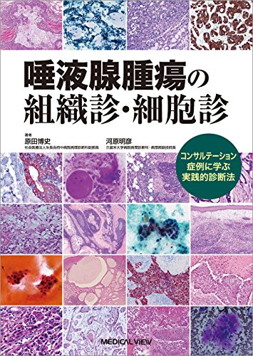 無料電子書籍アプリ 唾液腺腫瘍の組織診・細胞診−コンサルテーション症例に学ぶ実践的診断 バイ