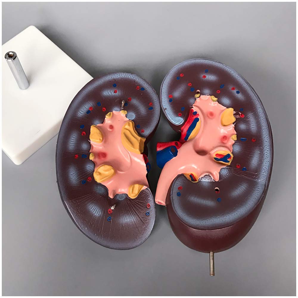 GTHTUHFD Educational Model 2X Magnification Human Kidney Model Medical Kidney Model Human Organ Model Detachable Kidney Structure Adrenal Gland Anatomy Model,Medical Models